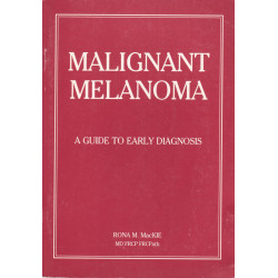 Malignant melanoma : a guide to early diagnosis